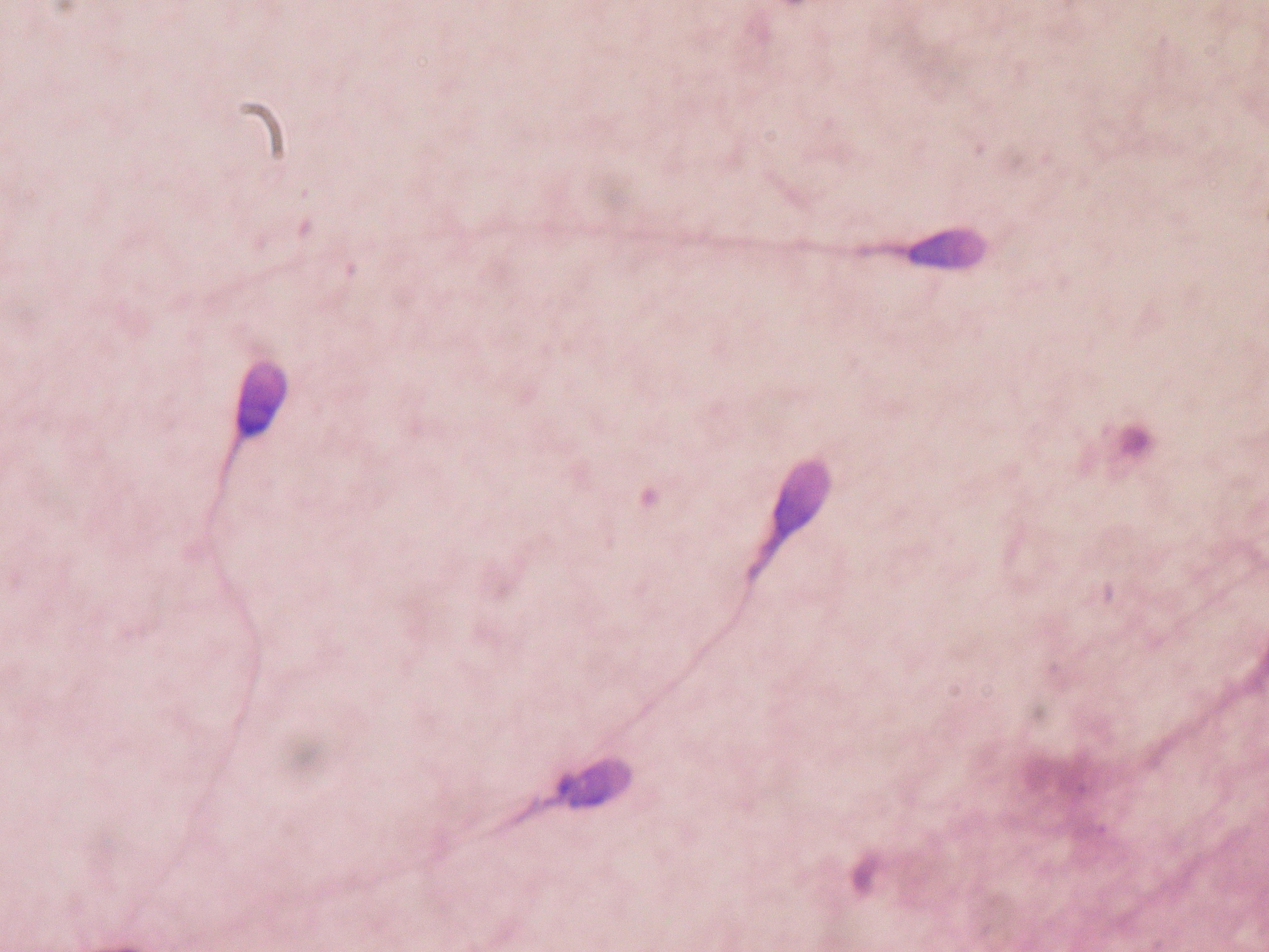 Spermatogenesis: production of gamete (sperm)